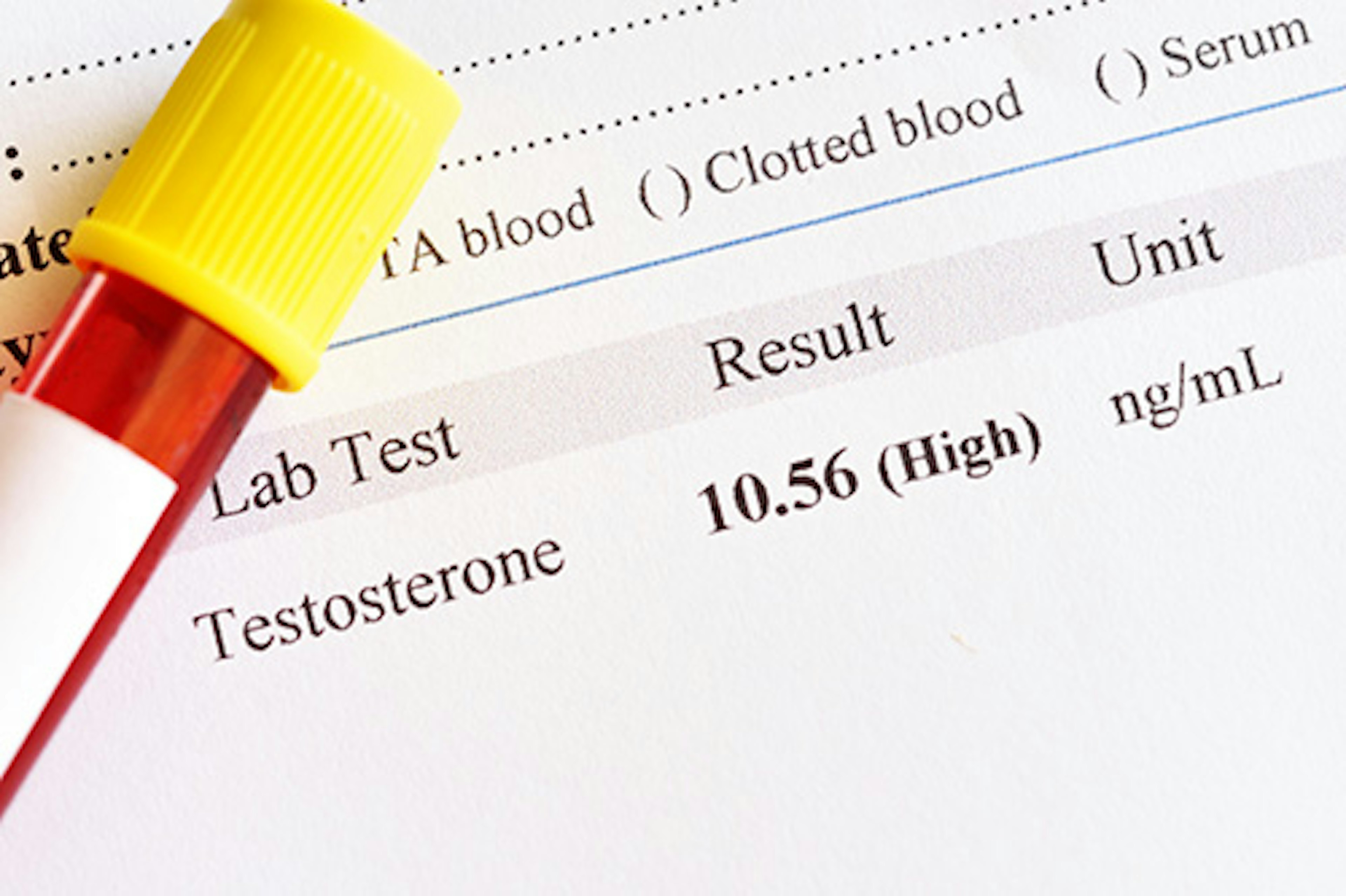 What you need to know about high testosterone.