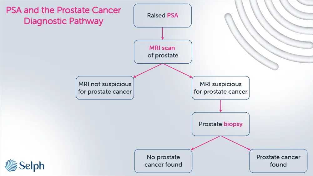 PSA and the Prostate Cancer Diagnostic Pathway