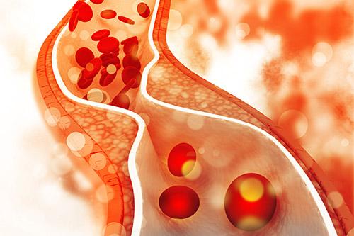 What do my lipid and cholesterol blood test results mean?