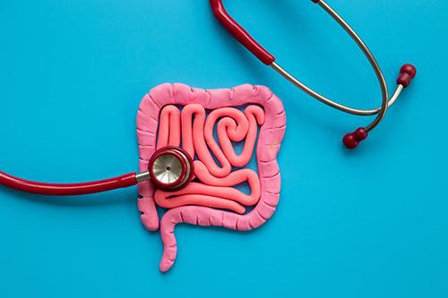 What are the symptoms of bowel cancer?