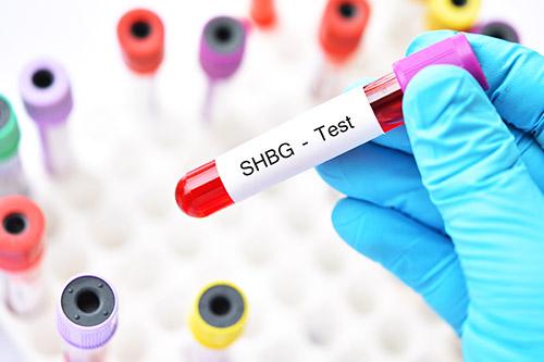 What is sex hormone binding globulin (SHBG)?