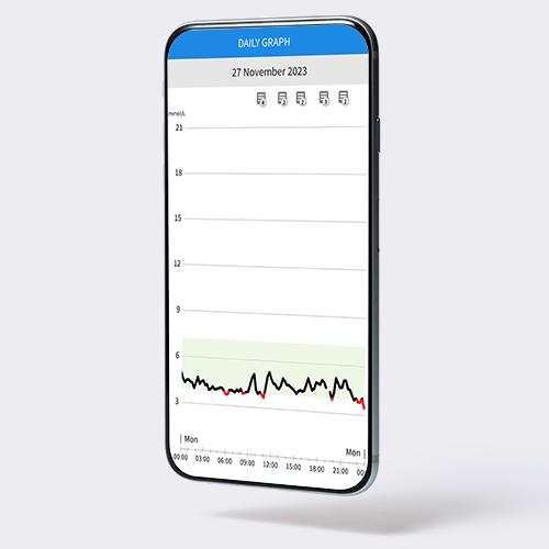 A typical continuous glucose trace